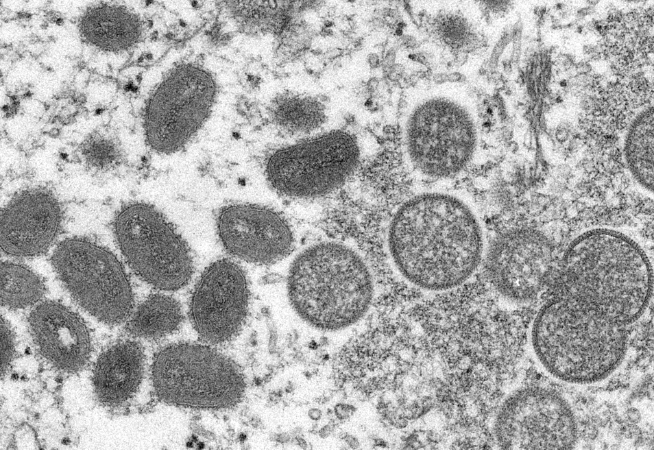 primeiro-caso-de-variola-dos-macacos-no-brasil-e-confirmado-em-sp